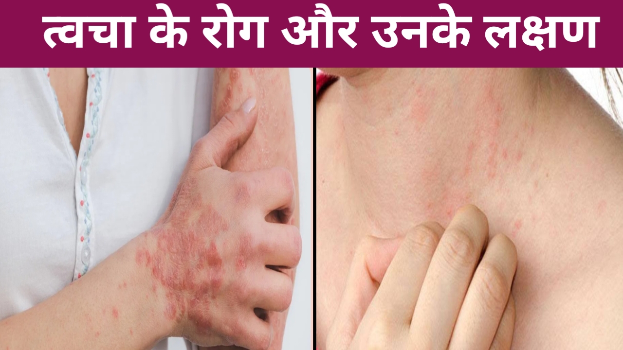 त्वचा के रोग और लक्षण